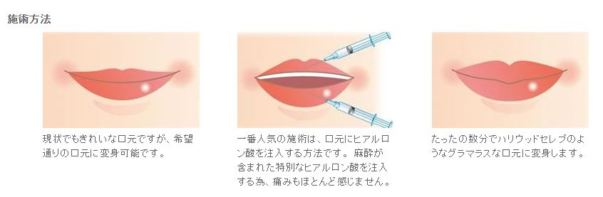 lip.JPG