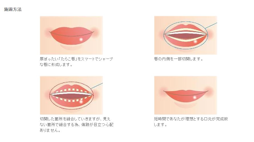lip2.JPG
