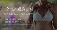 女性の鳩胸とは何かを治し方や特徴・改善のための有効な方法について解説