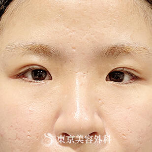 before 症例