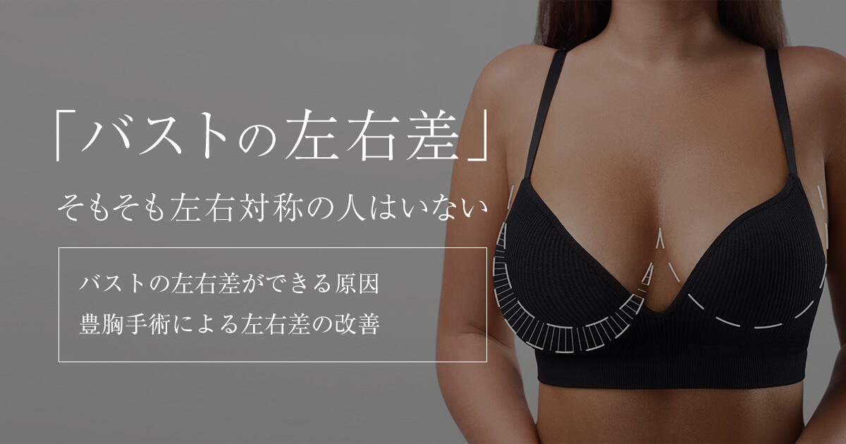 左右のバストの大きさが違う理由と改善方法は？乳がんや病気の可能性もあるの？