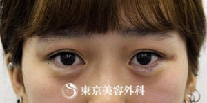 si886_1_a1-thumb-309xauto-4583.jpg