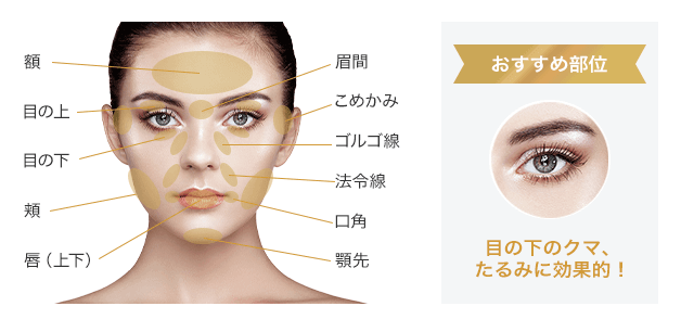 顔の脂肪注入 美容整形は東京美容外科