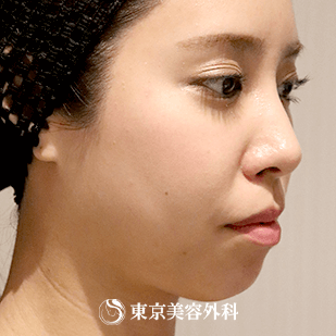 山本 崇弘医師紹介 美容整形は東京美容外科