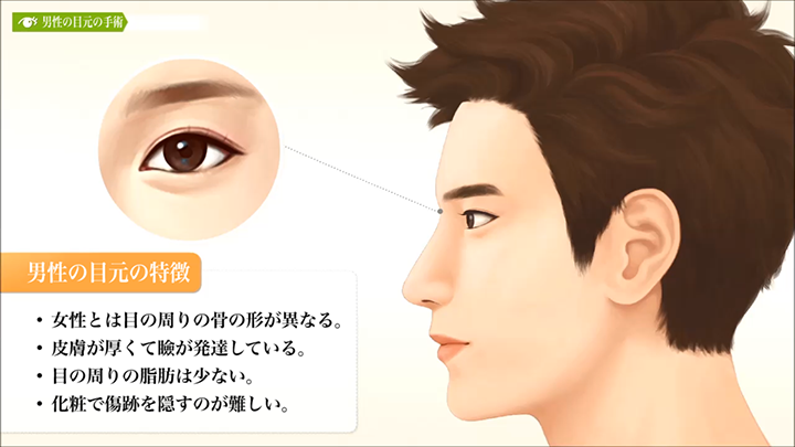 医師監修 男性の目元の手術 二重 美容整形は東京美容外科