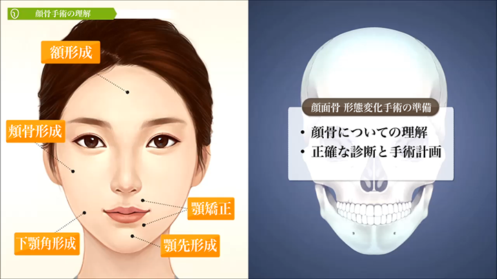 医師監修】～顔骨手術の理解～ | 美容整形は東京美容外科