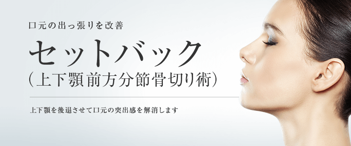 セットバック（上・下顎分節骨切り）