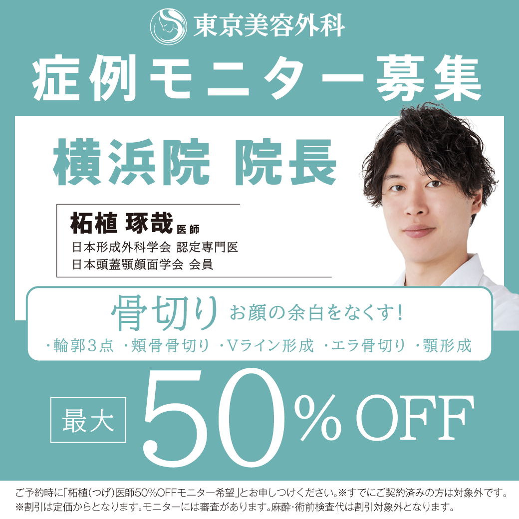 柘植医師による輪郭形成モニター募集