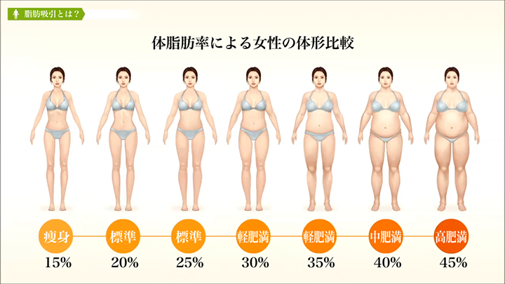 医師監修 脂肪吸引 体脂肪の特性 美容整形は東京美容外科