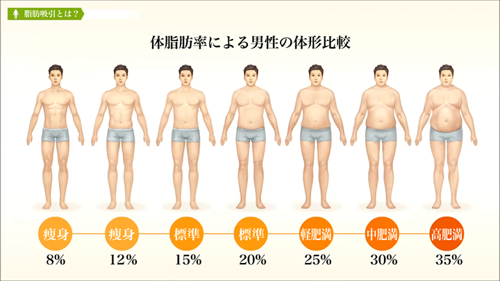 医師監修 脂肪吸引 体脂肪の特性 美容整形は東京美容外科