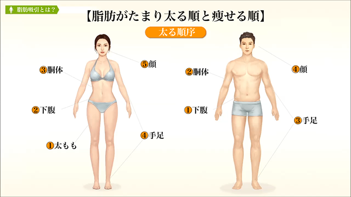 医師監修 脂肪吸引 体脂肪の特性 美容整形は東京美容外科