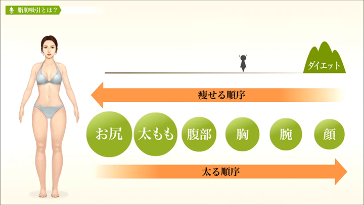医師監修 脂肪吸引 体脂肪の特性 美容整形は東京美容外科