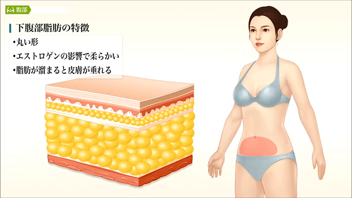 医師監修 腹部の脂肪吸引 特徴 美容整形は東京美容外科