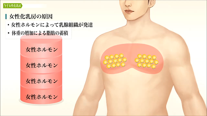 ホルモン 女体化 MTF 2 Years Estrogen Update (Steroid‘s ADR & HRT)