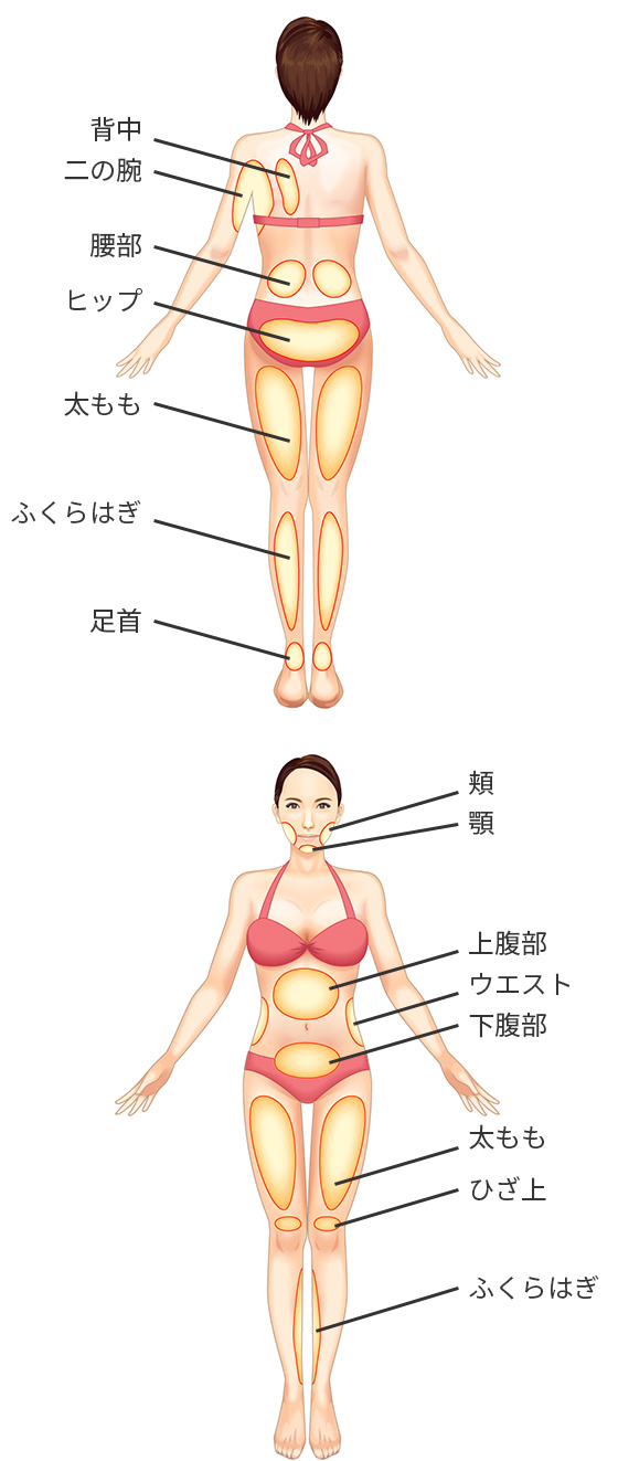 医療痩身（クリニック痩身）|東京美容外科