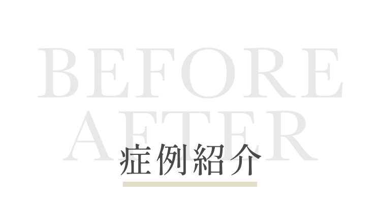  症例紹介　