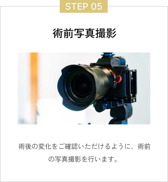  ステップ5術前写真撮影