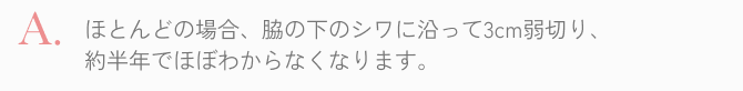  ほとんどの場合、約半年でほぼわからなくなります