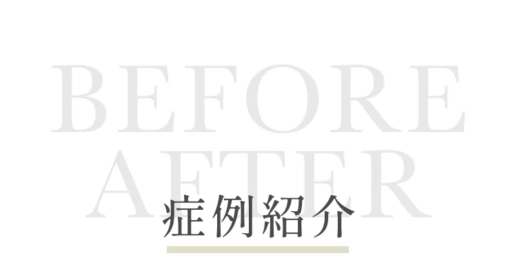 症例紹介　