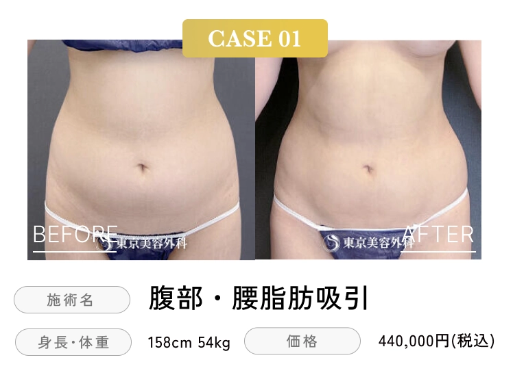 case01