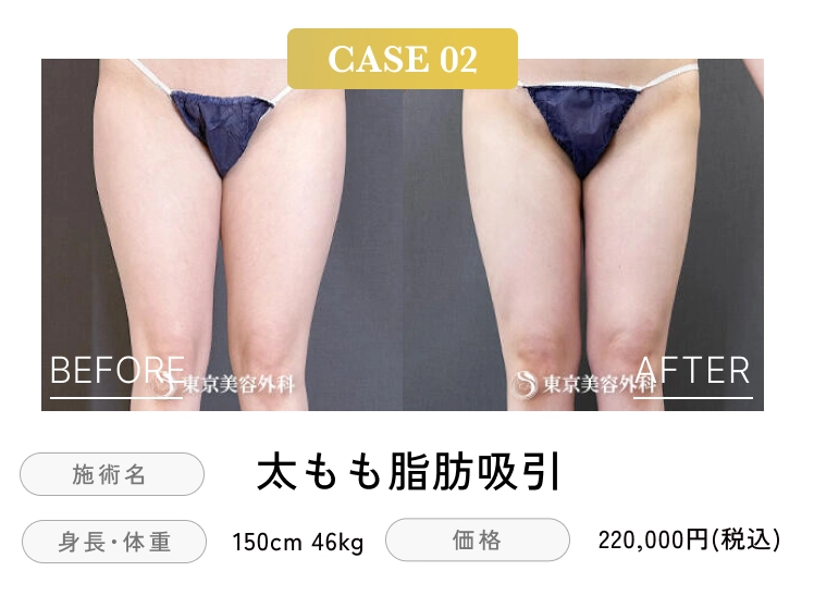 case02