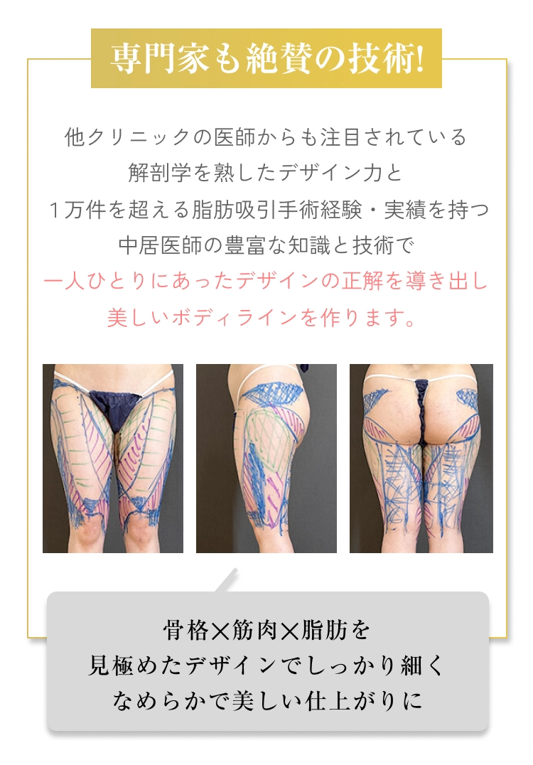 case02