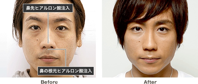 出来る男は始めてる 東美式メンズ整形 美容整形は東京美容外科