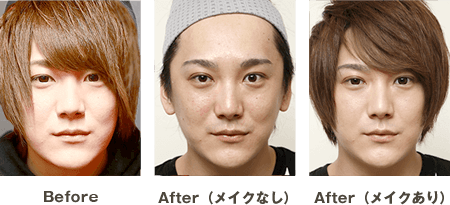 出来る男は始めてる 東美式メンズ整形 美容整形は東京美容外科
