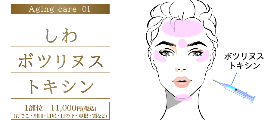 しわボツリヌストキシン