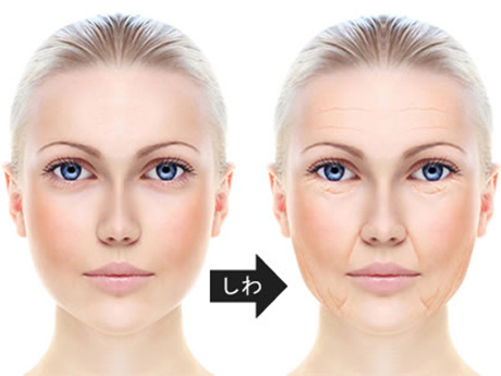 医師監修 様々な原因によるしわ 美容整形は東京美容外科