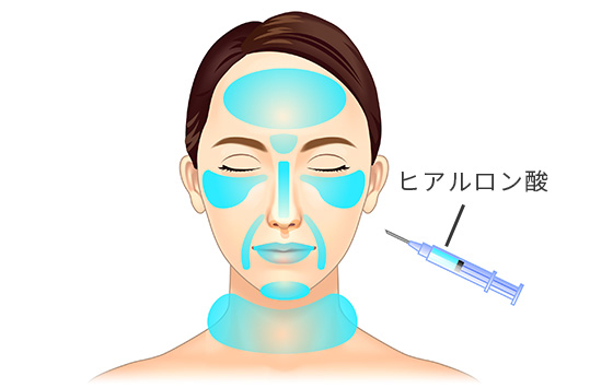 ヒアルロン酸注入による しわ治療 美容整形は東京美容外科