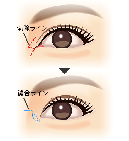 は と 蒙古 襞 西洋人は蒙古ひだが羨ましい？！日本人の蒙古襞が可愛い理由