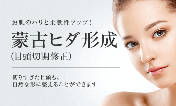 蒙古ヒダ形成 目頭切開修正 美容整形は東京美容外科 蒙古ヒダ形成 目頭切開修正 美容整形は東京美容外科